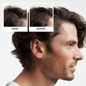 Kit Para Adelgazamiento Y Caída Capilar Sistema 2 - 700 ml - Nioxin