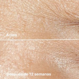 Crema Antiarrugas Smart Clinical Repair Wrinkle Correcting Rich Cream - Clinique