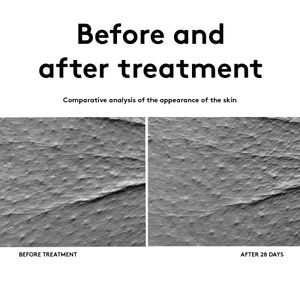 Contorno De Ojos Antiedad - Korff