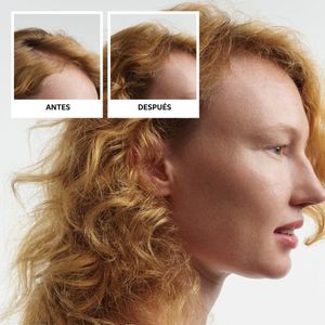 Kit Para Adelgazamiento Y Caída Capilar Sistema 1 - 350 ml - Nioxin