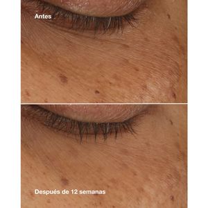 Concentrado de Suero para el Contorno de Ojos All About Eyes Brightening Serum Concentrate - Clinique
