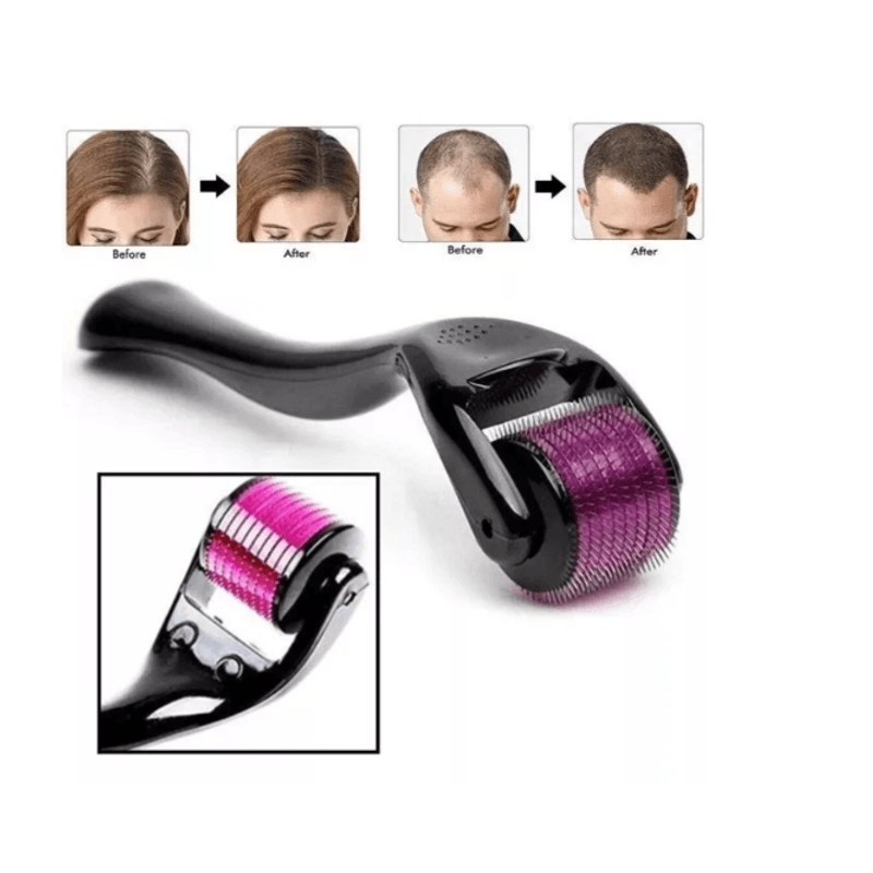 image-d409d9100ae84a79af9e85d6cabf8ab3